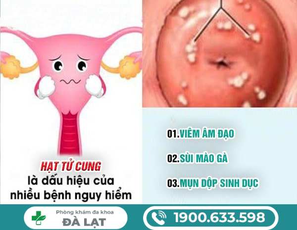 Hình ảnh minh họa